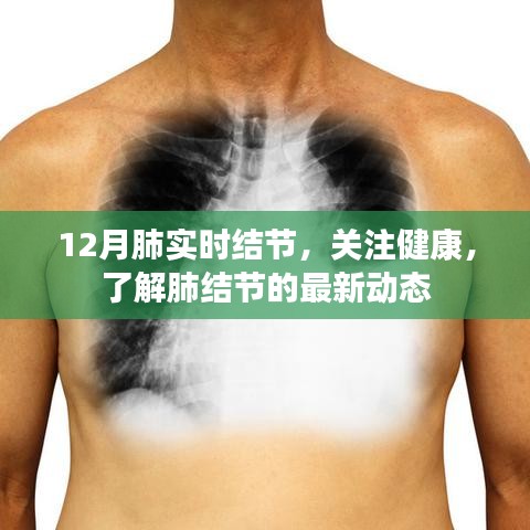 關(guān)注健康，12月肺實(shí)時(shí)結(jié)節(jié)最新動(dòng)態(tài)解讀