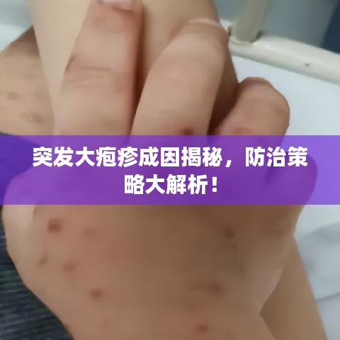 突發(fā)大皰疹成因揭秘，防治策略大解析！