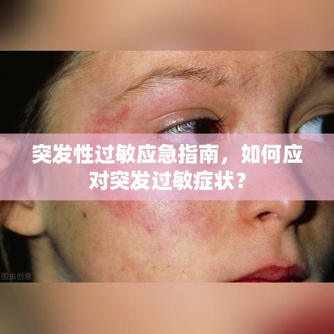 突發性過敏應急指南，如何應對突發過敏癥狀？
