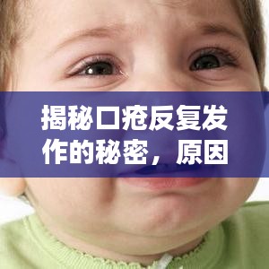 揭秘口瘡反復發作的秘密，原因何在？