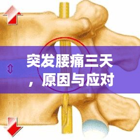 突發(fā)腰痛三天，原因與應(yīng)對方法探討
