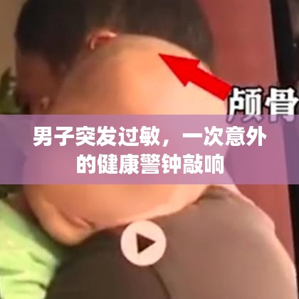 男子突發過敏，一次意外的健康警鐘敲響