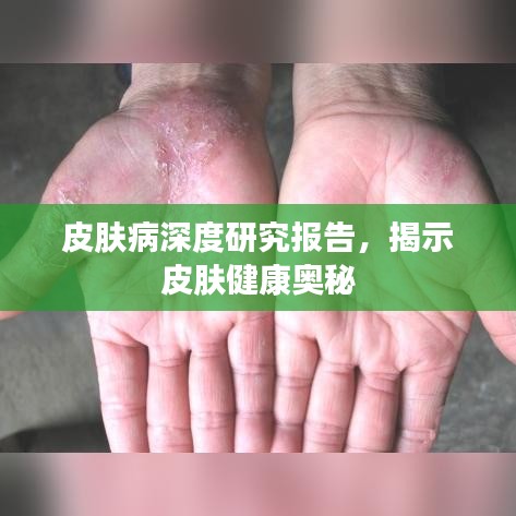 皮膚病深度研究報告，揭示皮膚健康奧秘