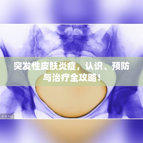 突發性皮膚炎癥，認識、預防與治療全攻略！